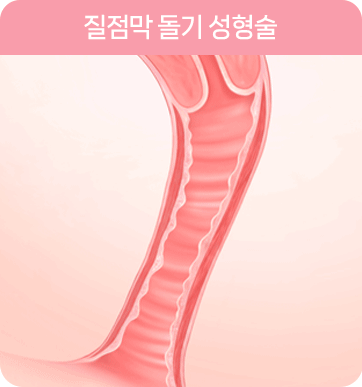질축소수술 : 다움 리본 질성형술 Vaginal tightening surgery: Daum Ribbon Vaginal Rejuvenation
