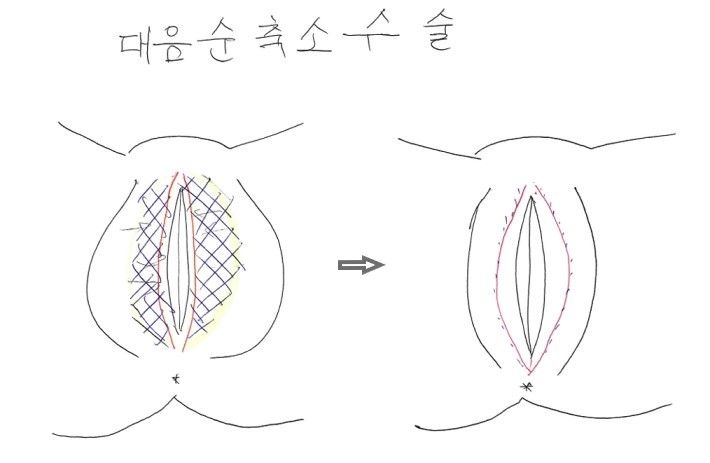 296fc8217430df190fe32318b76c8a2e_1765787598_5313.jpeg 296fc8217430df190fe32318b76c8a2e_1765787598_5313.jpeg