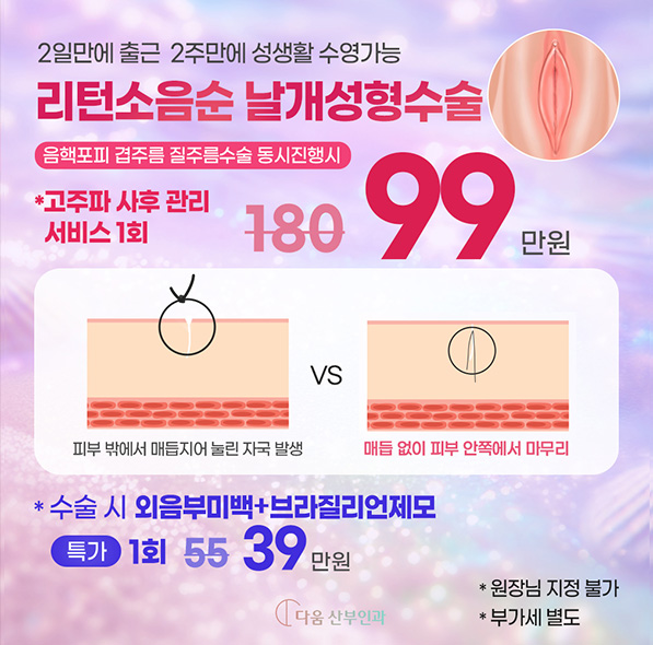 리턴소음순수술 올인원패키지