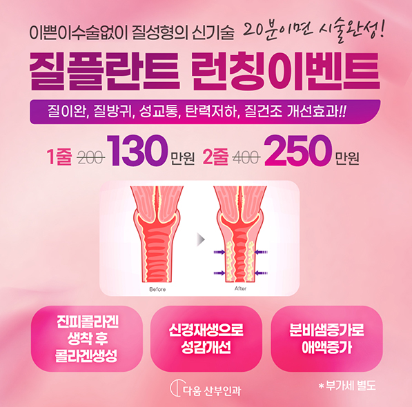 질플란트 런칭이벤트